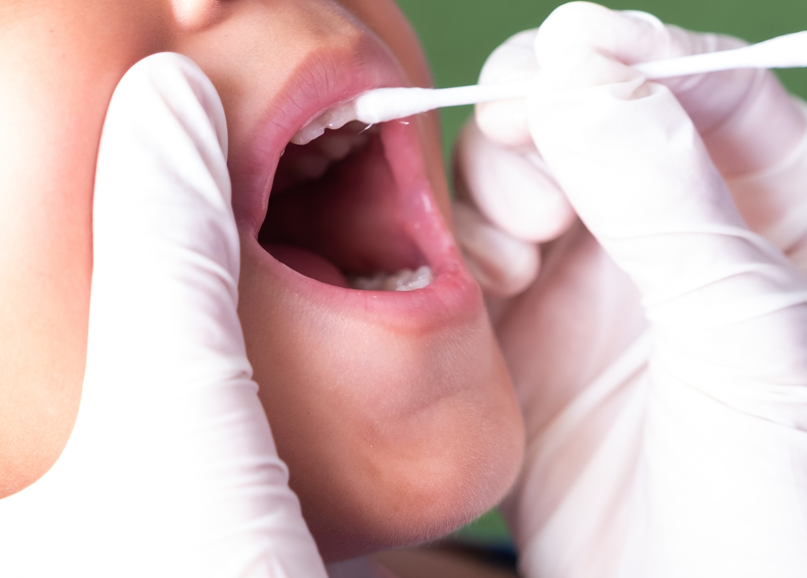 Benefits of fluoride beyond cavity prevention