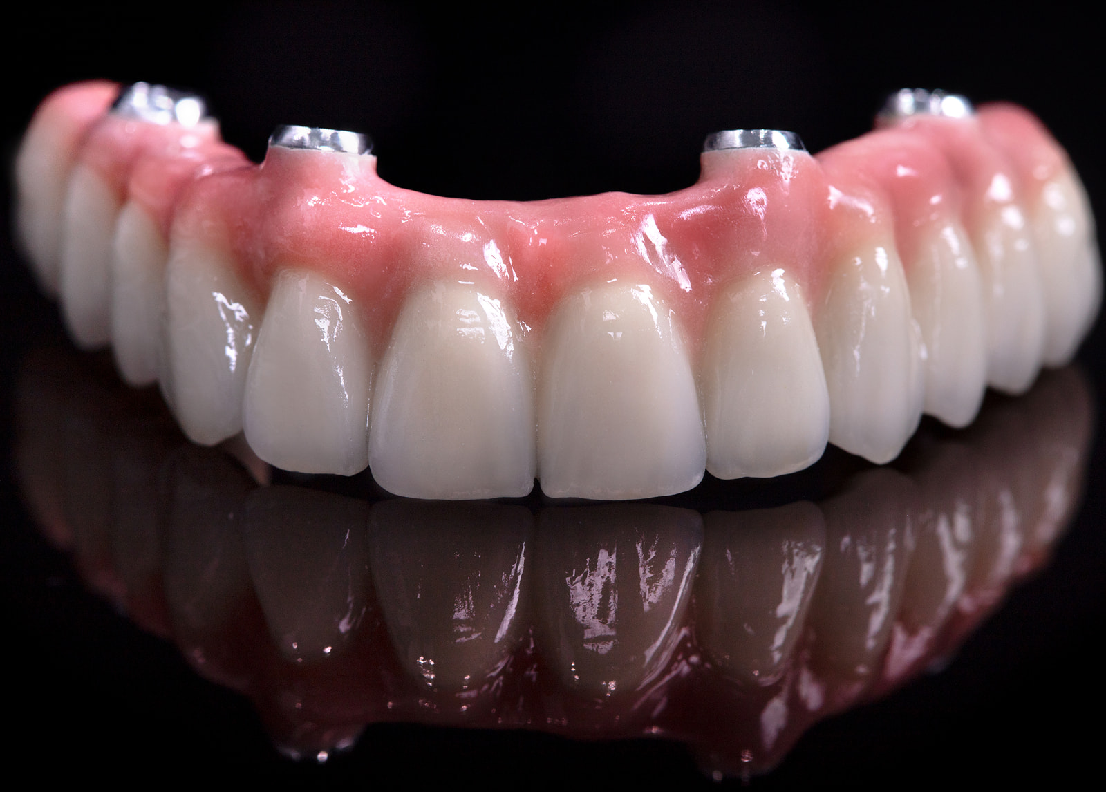 Comfortable and stable implant denture benefits for lasting confidence