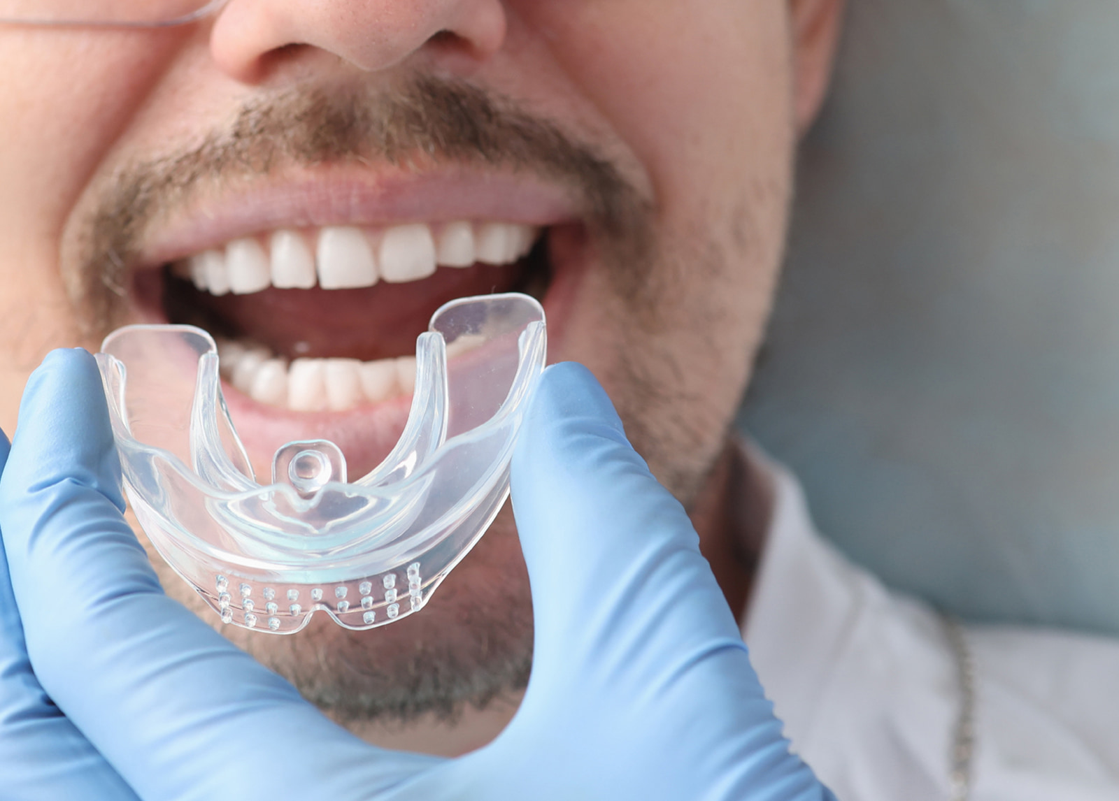 Dental care for bruxism to stop grinding and jaw pain