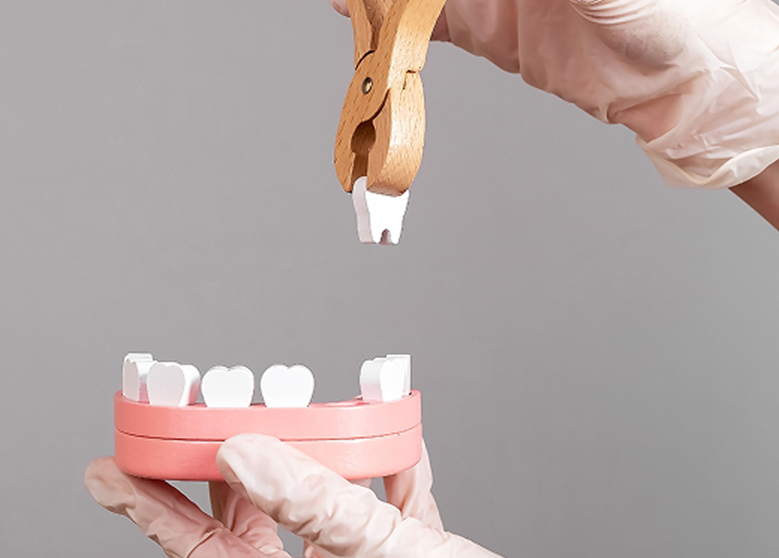 Tooth extraction to protect smile and prepare for implants or bridges
